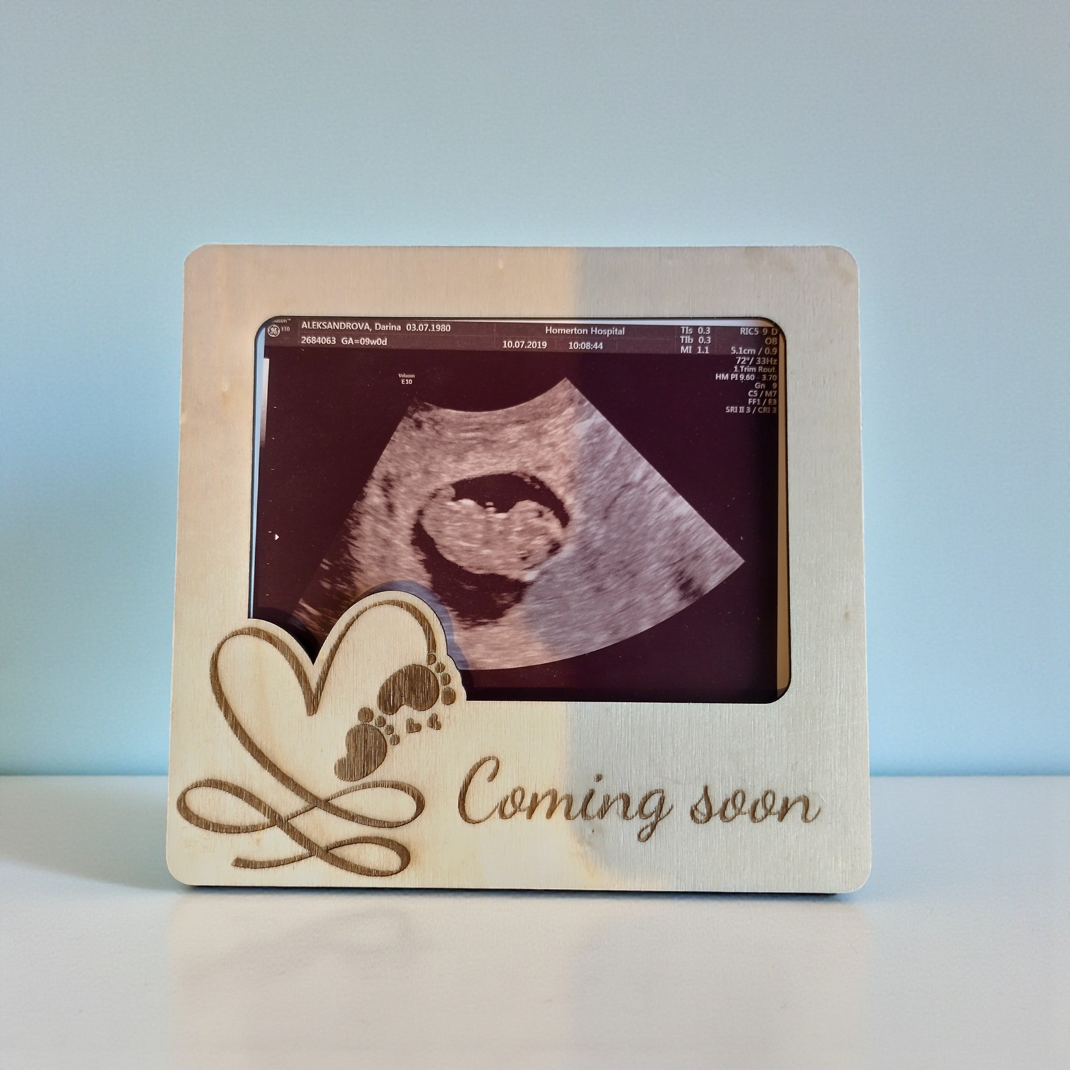 Wooden Ultrasound Photo Frame Magnet