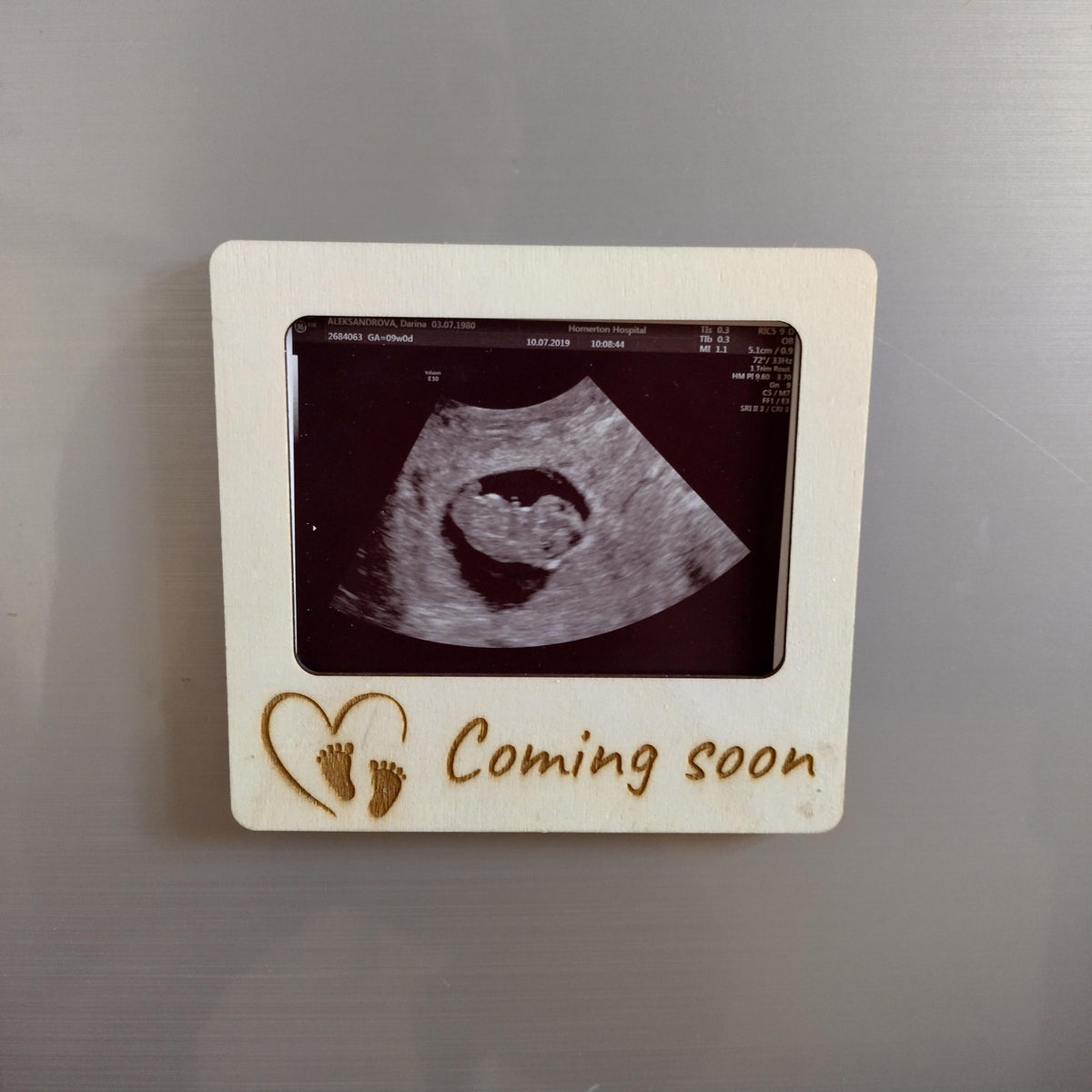 Personalised Ultrasound Photo Frame | Baby Scan Keepsake Magnet | Sonogram Frame | Pregnancy Gift | Coming Soon Baby Announcement - product photo 4