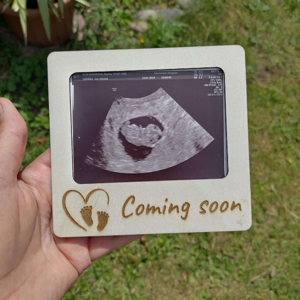 Personalised Ultrasound Photo Frame | Baby Scan Keepsake Magnet | Sonogram Frame | Pregnancy Gift | Coming Soon Baby Announcement - product photo 7
