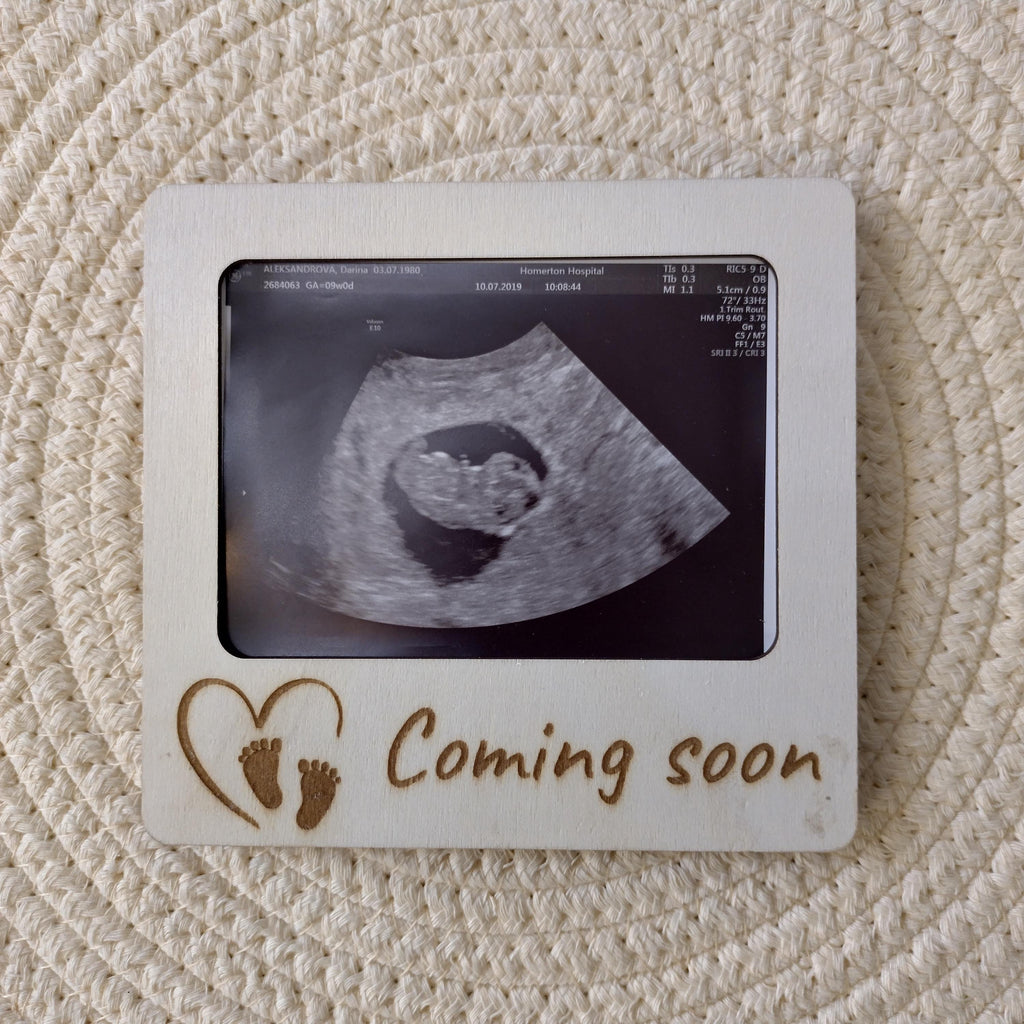 Personalised Ultrasound Photo Frame | Baby Scan Keepsake Magnet | Sonogram Frame | Pregnancy Gift | Coming Soon Baby Announcement - product photo 3