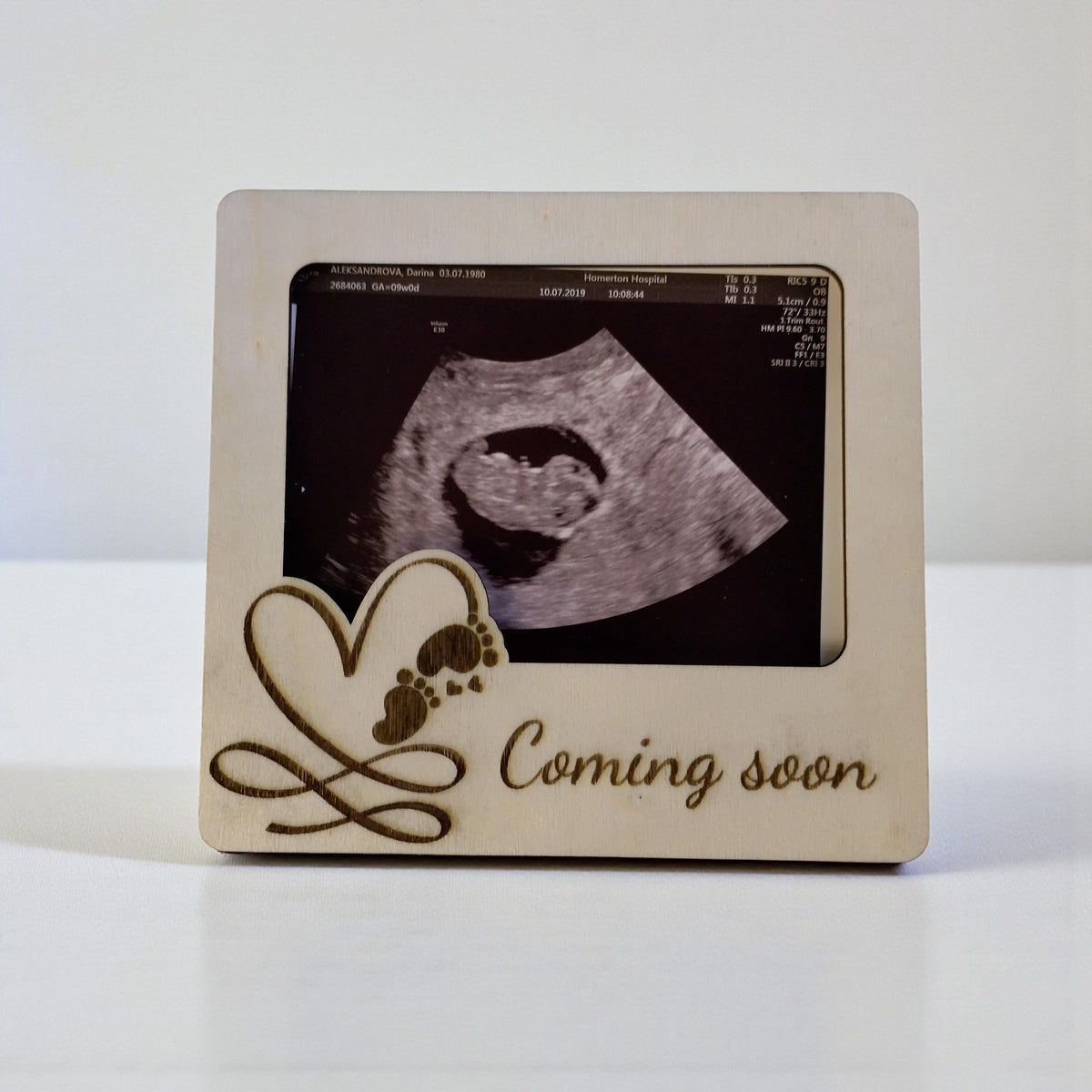 Wooden Ultrasound Photo Frame Magnet | Sonogram Fridge Magnet | Baby Scan Keepsake | Pregnancy Announcement Gift | Coming Soon