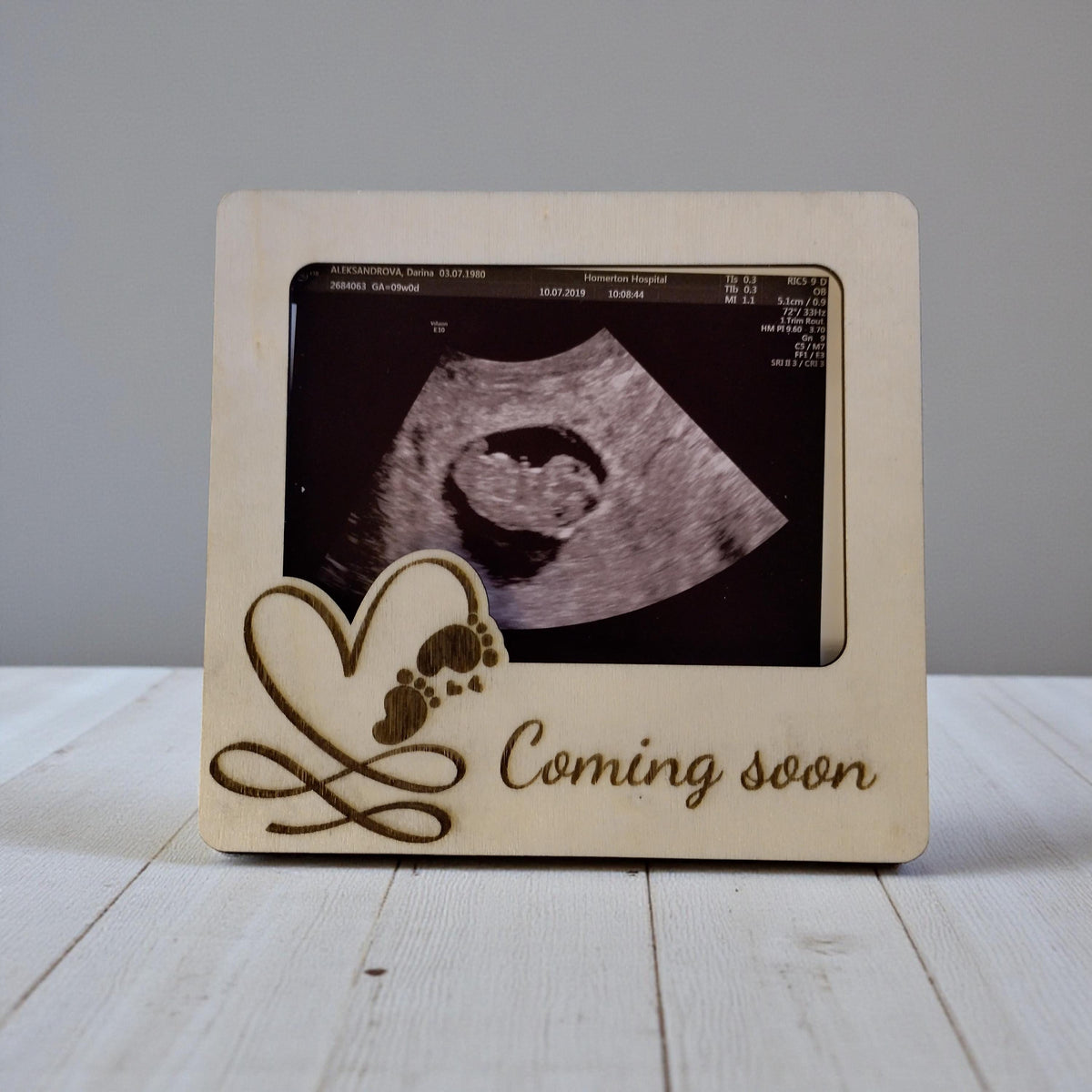 Wooden Ultrasound Photo Frame Magnet | Sonogram Fridge Magnet | Baby Scan Keepsake | Pregnancy Announcement Gift | Coming Soon - product photo 7