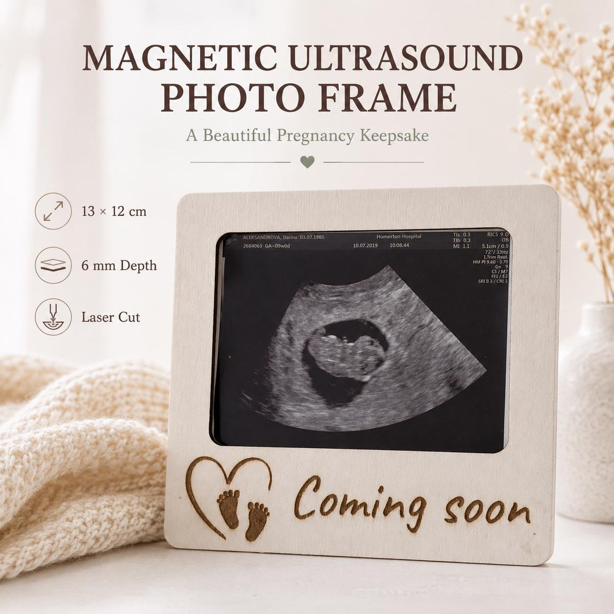 Personalised Ultrasound Photo Frame | Baby Scan Keepsake Magnet | Sonogram Frame | Pregnancy Gift | Coming Soon Baby Announcement